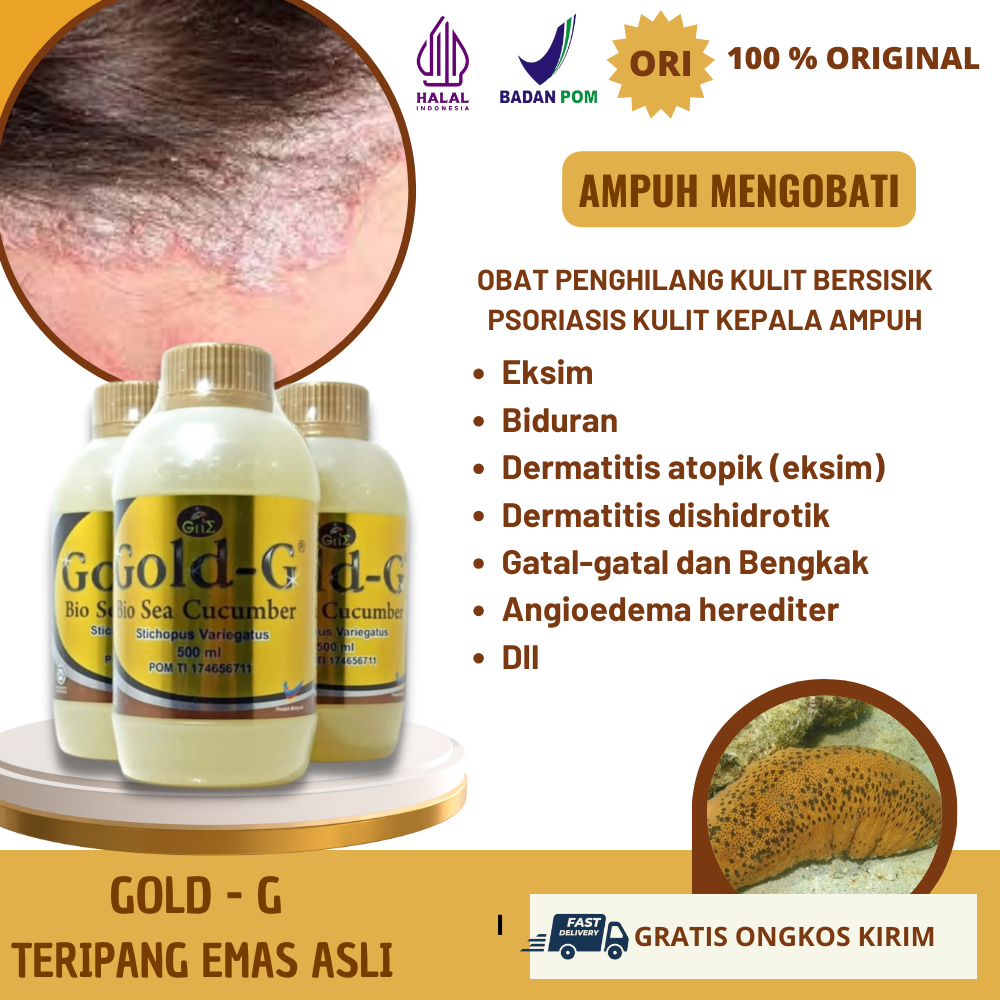 Obat Psoriasis Kulit Kepala, Obat Penghilang Kulit Bersisik di Kepala Leher Siku Tangan Kaki Lutut P