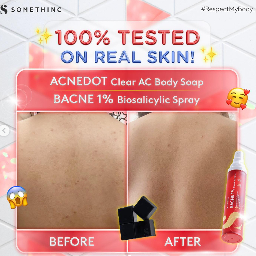 Somethinc Acnedot Clear AC Body Soap Sabun Jerawat | Sabun Jerawat Punggung Ampuh | Jerawat Punggung