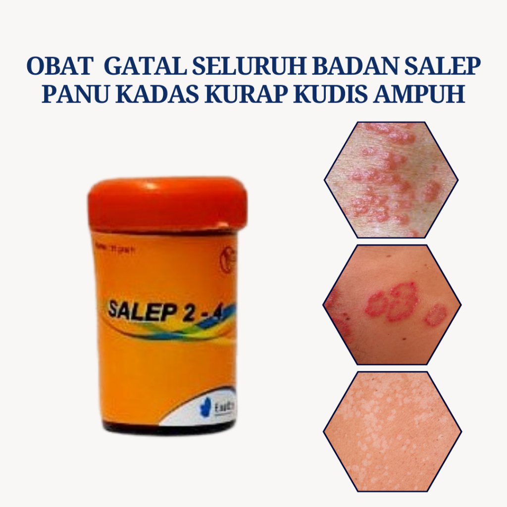 Obat Salep Gatal Selangkangan Obat Panu Di Wajah Anak Paling Ampuh 100%