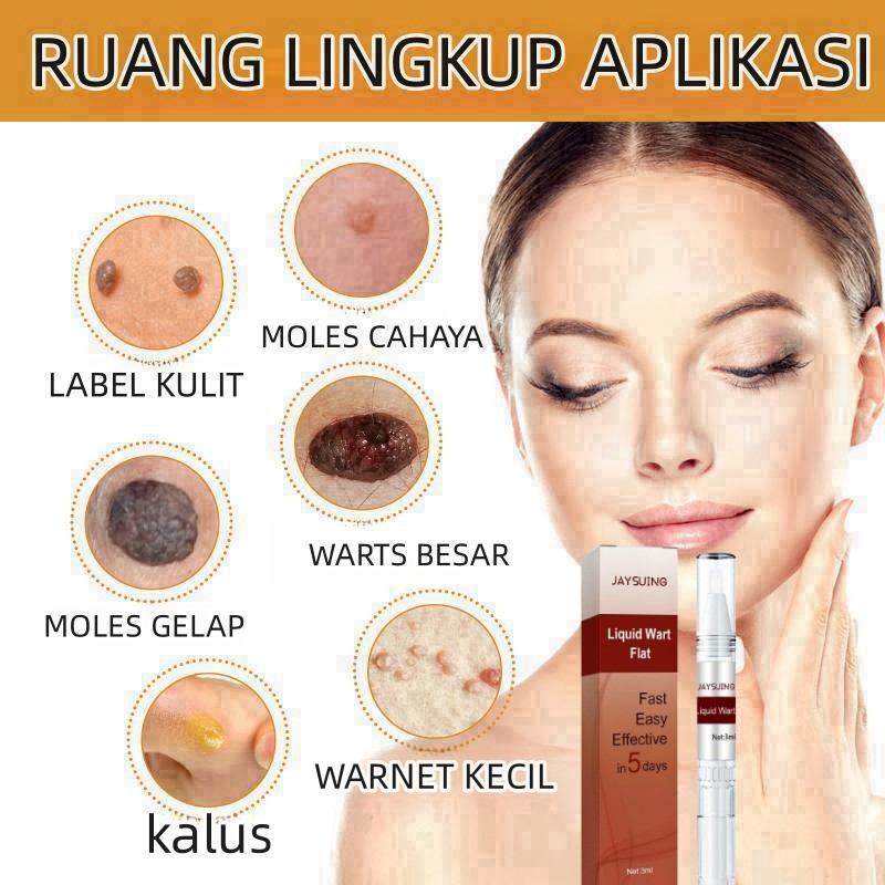 Penghilang kutil wart remover pen Penghilang Tahi Lalat Penghilang Kutil Skin Tag Remover Menghilangkan Tahi Lalat