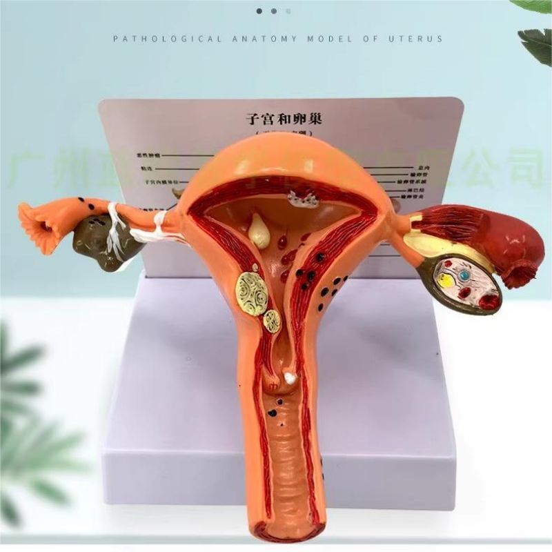 Uterus Ovary Anatomical Model Anatomy Alat Peraga Anatomi Model Patologis Uterus Ovarium Manekin