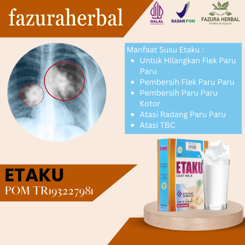 Etaku - Susu Penghilang Flek Paru Paru, Susu Pembersih Flek Paru, Susu Pembersih Paru Paru Kotor, Pe