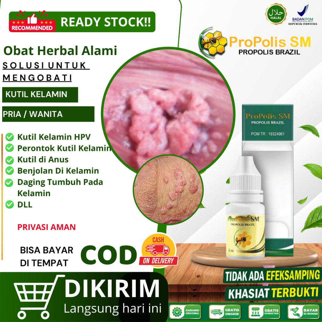 Obat Kutil Kelamin HPV,Obat Herbal Untuk Perontok Kutil Kelamin Pria & Wanita,Obat kutil Kelamin Pri