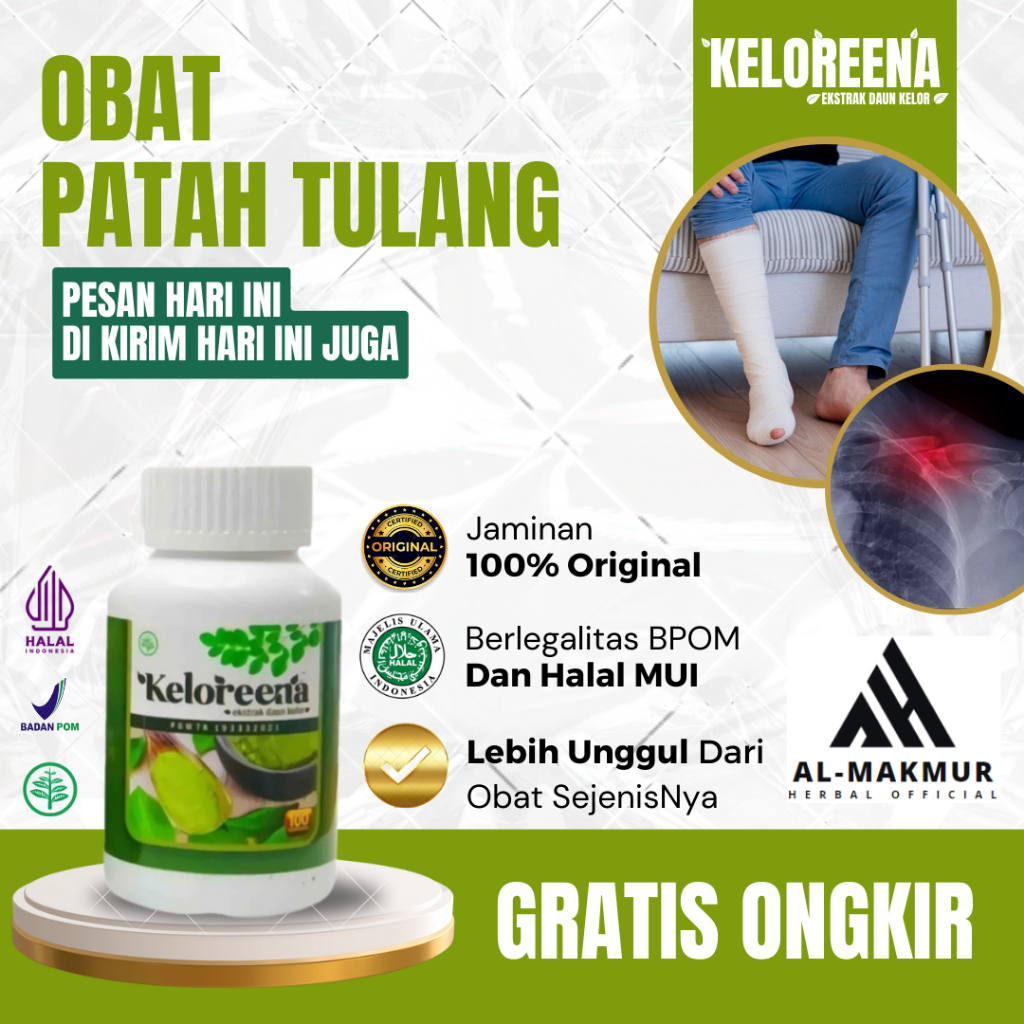 Obat Patah Tulang, Obat Fraktur Tulang, Obat Tulang Bergeser, Obat Penyambung Patah Tulang, Obat Tul