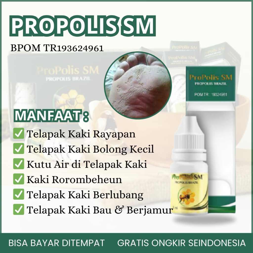 Obat Kaki Rayapan, Obat Telapak Kaki Bolong Bolong, Obat Telapak Kaki Berlubang, Obat Telapak Kaki P