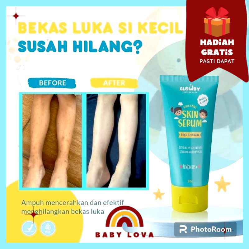 HADIAH GRATIS | GLOWBY Skin serum Lotion pemutih anak
