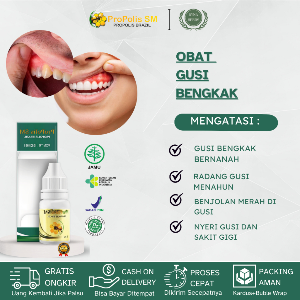 Obat Gusi Bengkak, Obat Sakit Gigi Berlubang, Obat Radang Gusi, Obat Plak Gigi, Obat Abses Gigi, Oba