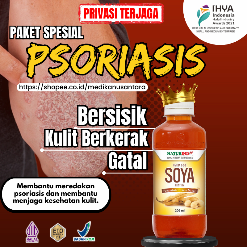 Obat Oles Herbal Psoriasis Gatal Kulit Kepala Lutut Bersisik Ketombe Berkerak Kering Bersisik Gatal 