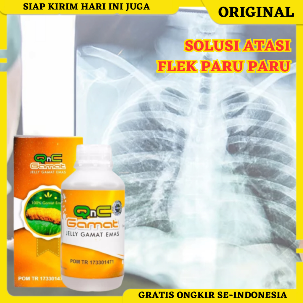 Obat Flek Paru Paru, Obat Flek Paru TBC, Obat Pembersih Flek Paru Paru, Obat Paru Paru Basah, Obat T