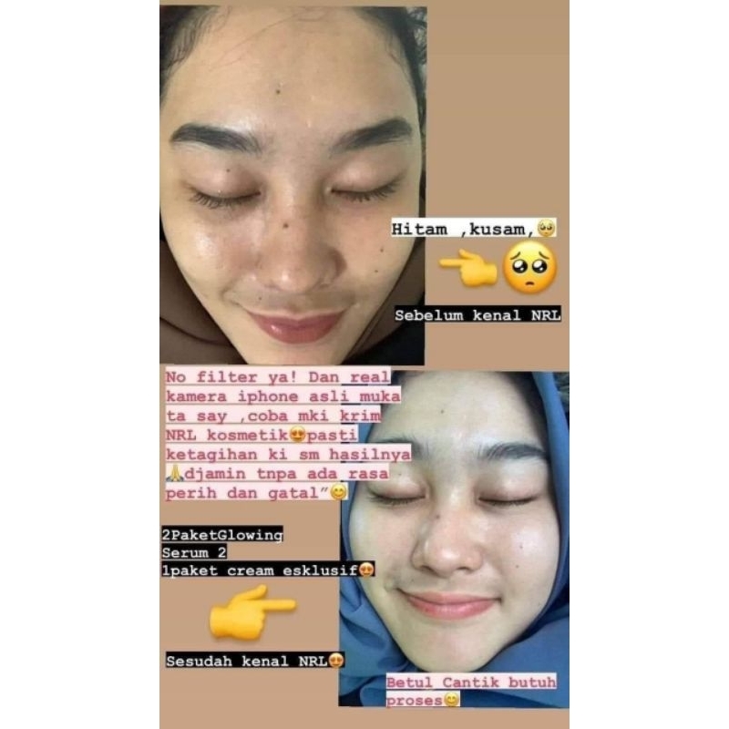 CREAM NRL EXCLUSIVE BPOM