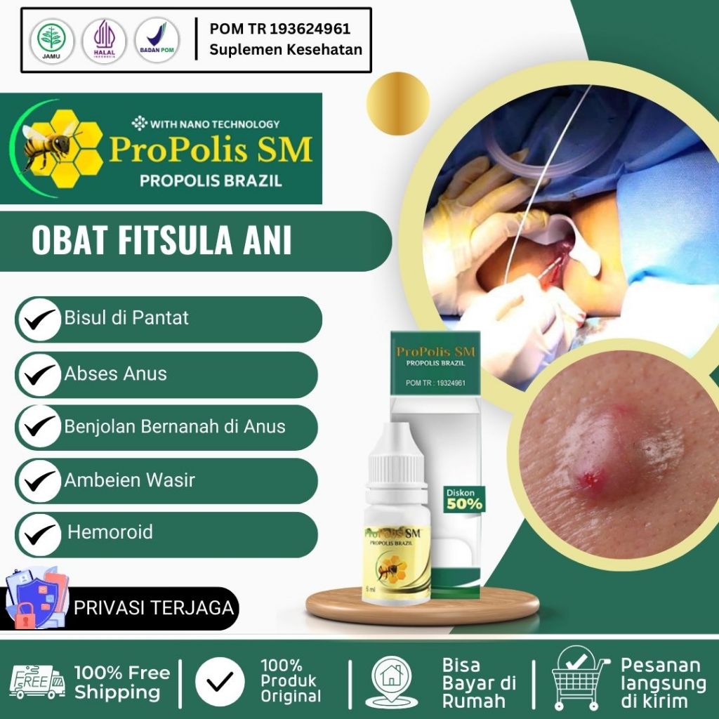 Obat Fistula Ani Bisul di Pantat Bisul Bernanah Abses Perianal Abses Anus Benjolan Bernanah di Anus 