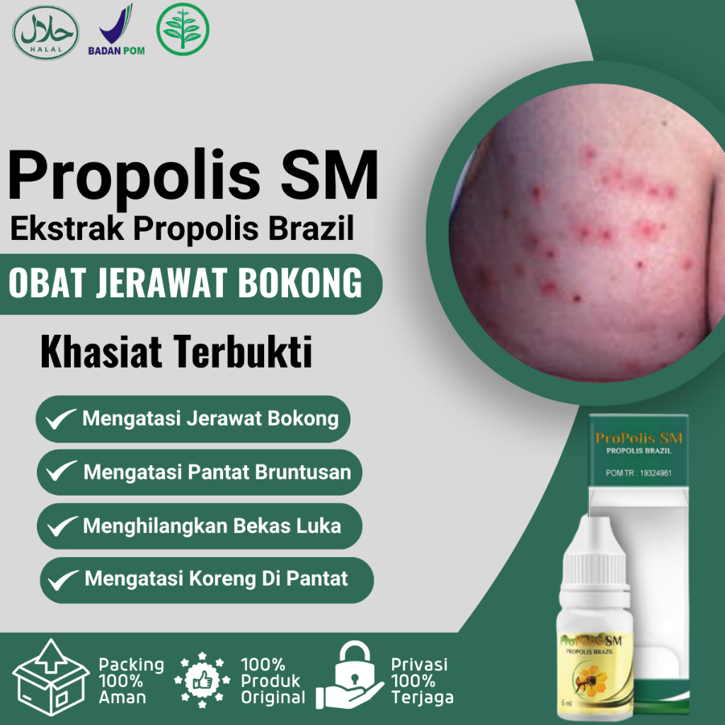 Obat Jerawat Bokong, Obat Jerawat Pantat Bruntusan, Obat Gatal Pantat, Obat Pantat Burik, Bokong Bur