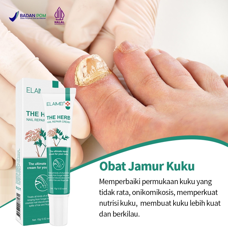 【ORIGINAL】obat jamur kuku obat kuku jamur dan rusak Perawatan Jamur Kuku  Pemutih Kuku Penghilang Ja
