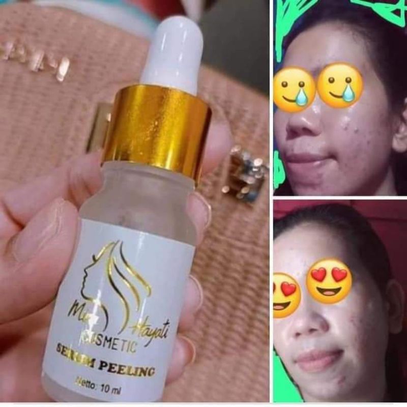SERUM MH COSMETIC