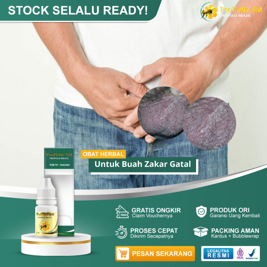 Obat Gatal Buah Zakar Salep Oles Gatal Buah Zakar Bentol Buah Zakar Lecet Buah Zakar Bentol Bernanah