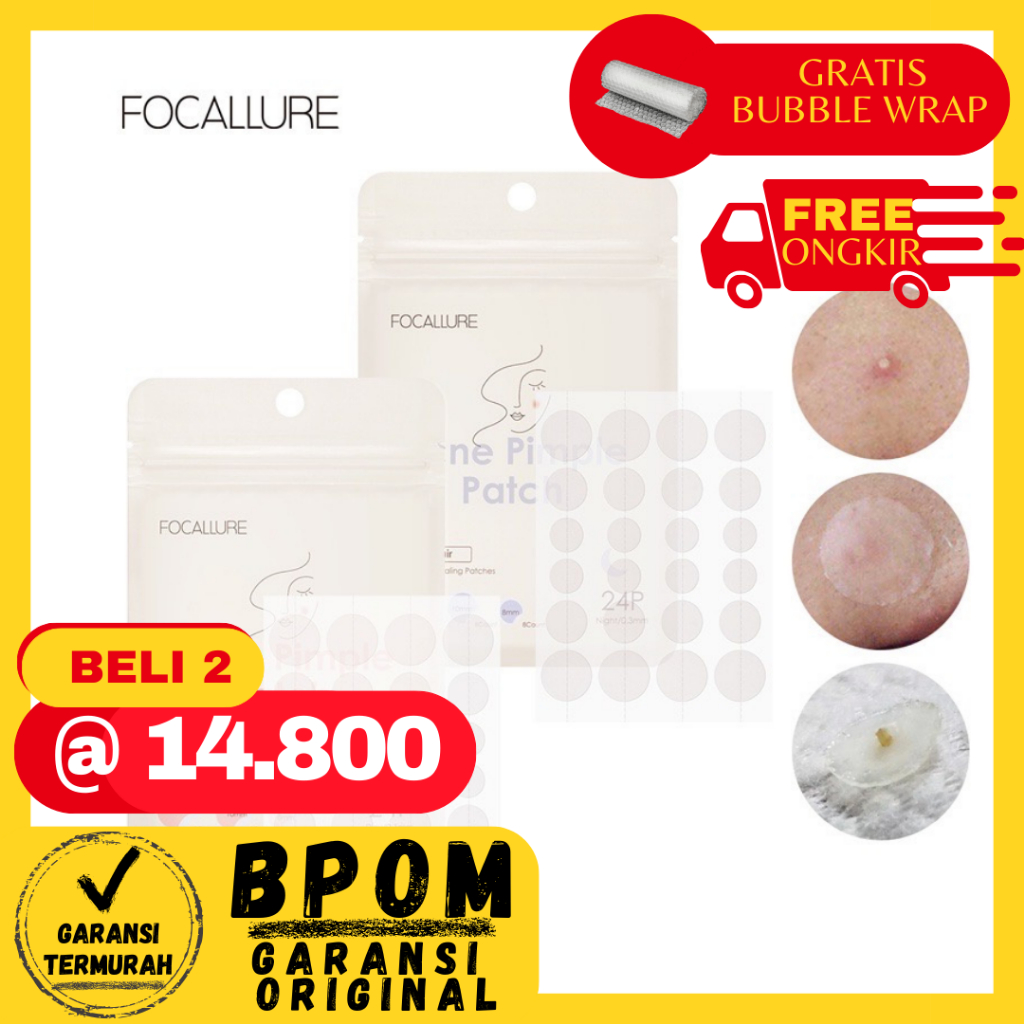 NEWBE- FOCALLURE Acne Patch Spot Patch Focallure Pimple Patch Acne Treatment Day/Night Focallure