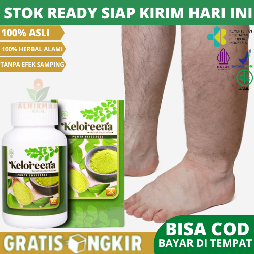 Obat Herbal Penyakit Kaki Gajah / Filariasis Limfatik, Obat Pembengkakan Di Tungkai Kaki, Obat Penge