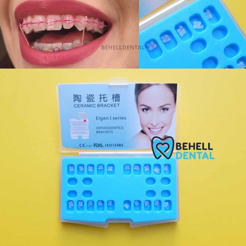 Bracket behel gigi permanen ceramic mini cute . Transfaran . Keramik . Bening . Transfaran Ori