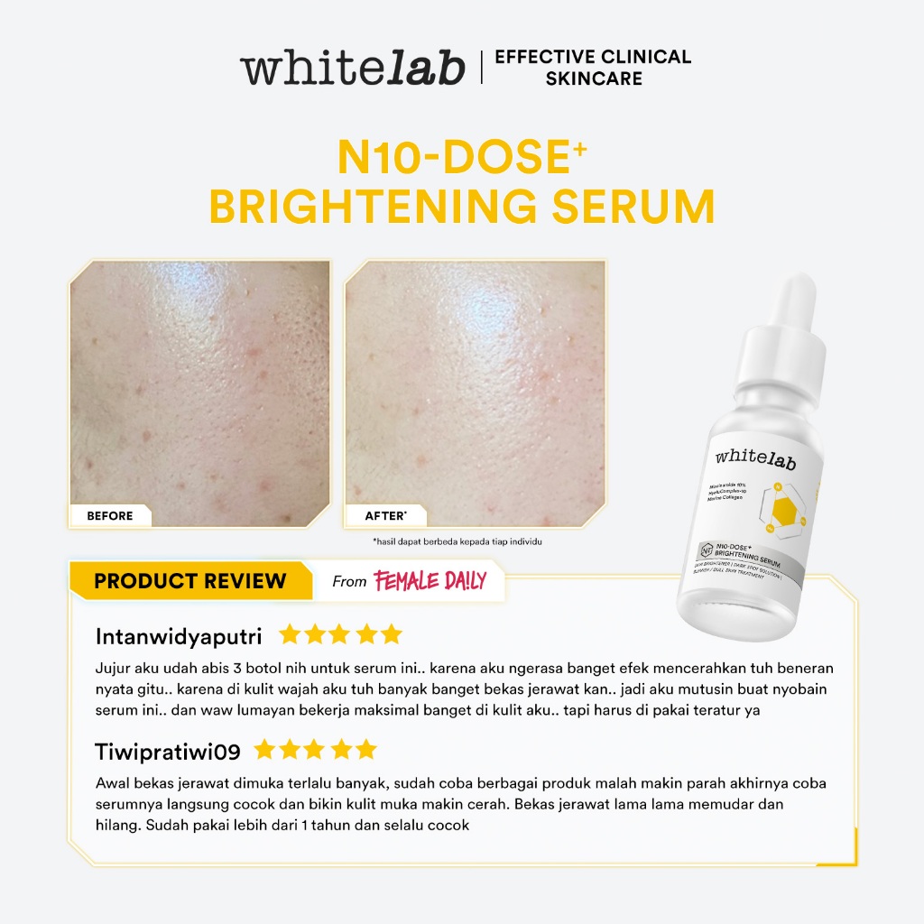 Whitelab N10-Dose+ Intense Brightening Serum Niacinamide 10% - Serum Pencerah Wajah Intensif Dengan Niacinamide, Hyaluronic & Collagen [BPOM] Image 5