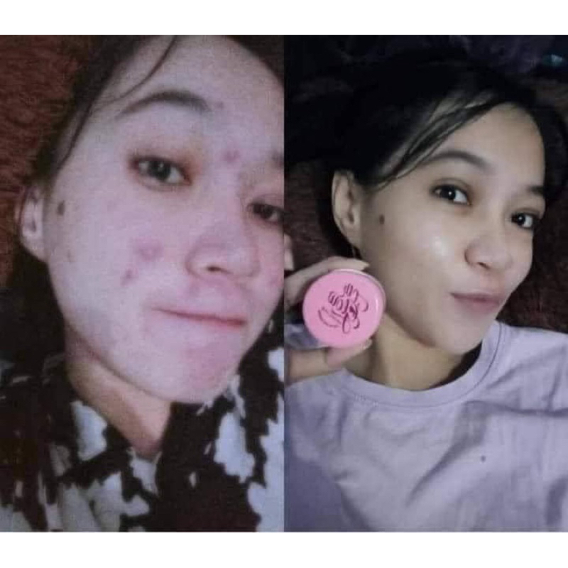 skincare clbglow