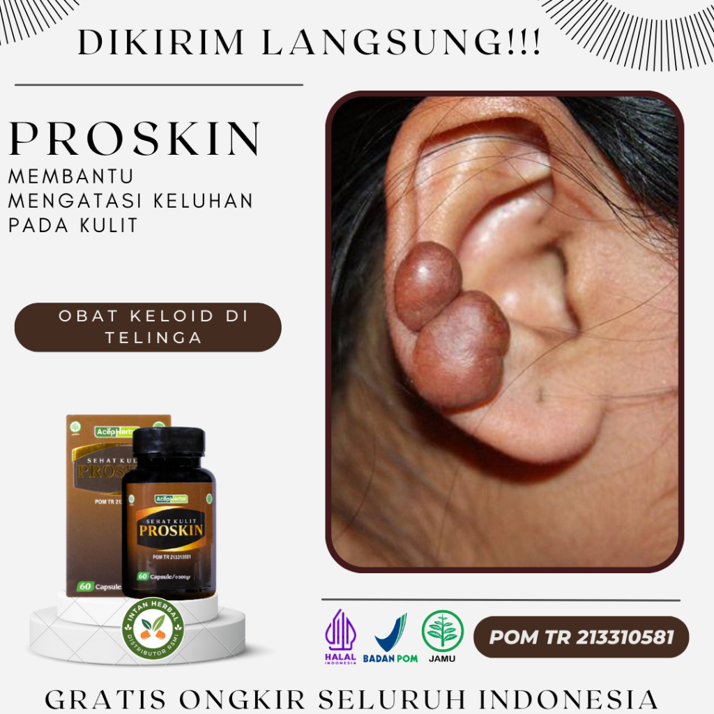 Proskin 100% Original - Obat Keloid Di Telinga, Keloid Menahun, Daging Tumbuh Di Telinga, Keloid Bek