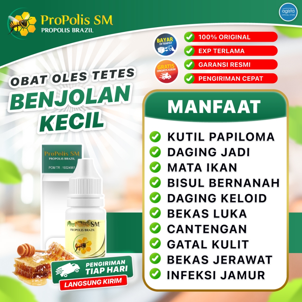 Obat Mata Ikan Telapak Kaki Penghilang Kutil Daging Jadi Propolis SM