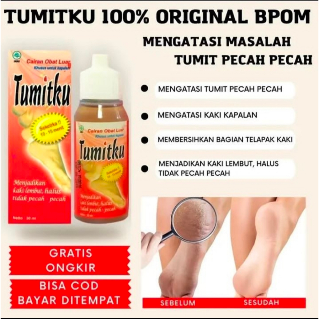 Obat kaki pecah TUMITKU original/penghilang kapalan/obat kaki kering kapalan/obat perawatan kaki