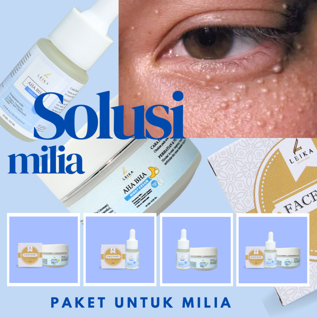 [PAKET Untuk Milia] Cream Milia Penghilang Milia Paling Ampuh Cream Milia Ampuh Bpom Penghilang Mili