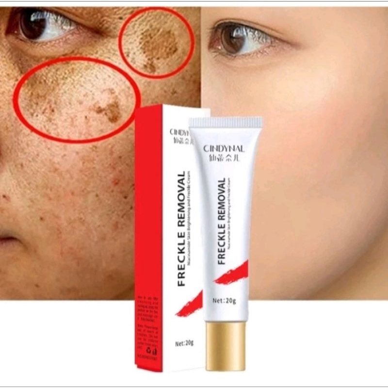 salep cindynal anti frenckle krim anti kerut
