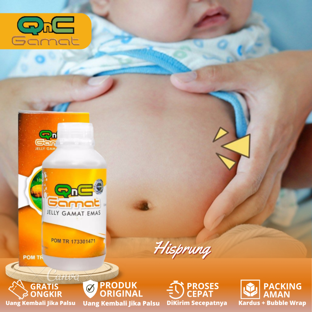 Obat Hisprung Pada Bayi, Hirschsprung, Susah BAB, Sembelit, Radang Usus Buntu, Pelancar Buang Air Be