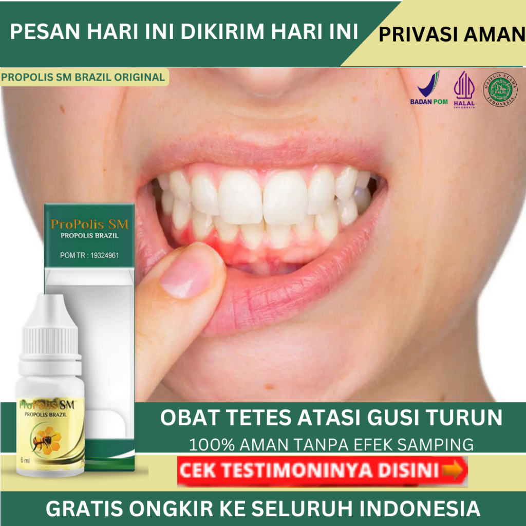 Obat Gusi Turun, Obat Resesi Gusi, Obat Gusi Bengkak Dan Sakit, Obat Radang Gusi,  Obat Gusi Berdara