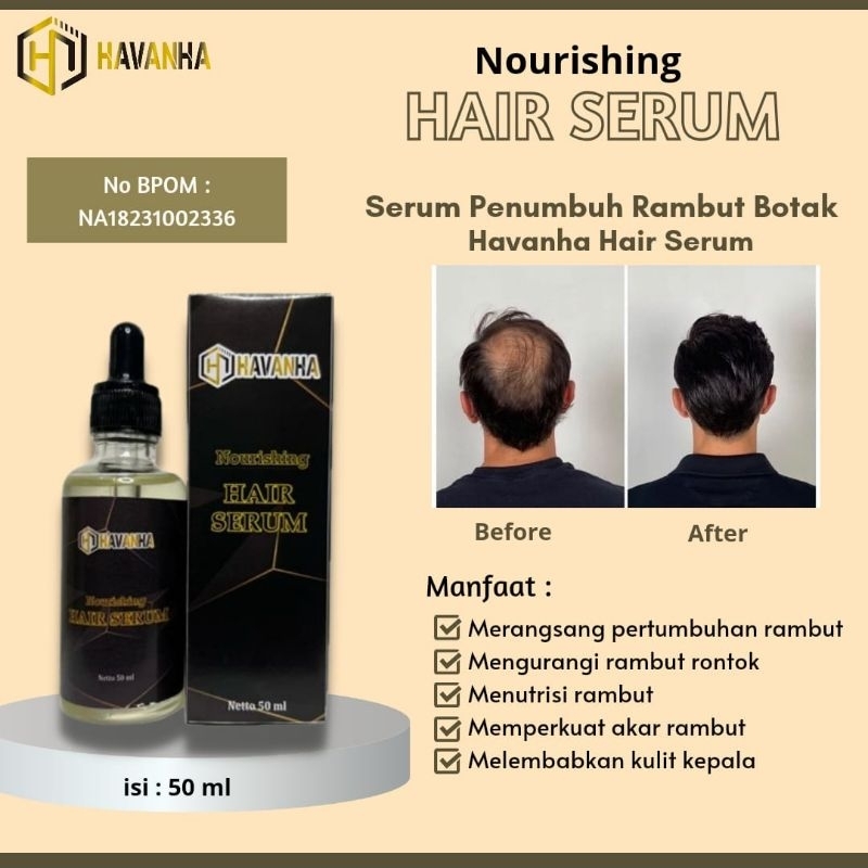 HAVANHA PENUMBUH RAMBUT BOTAK Pria Cepat Hair Growth Serum Rambut Rontok Wanita Penebal Penyubur Pel
