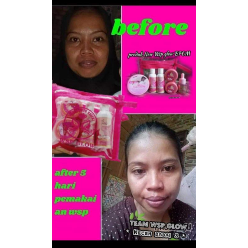 wsp skincare