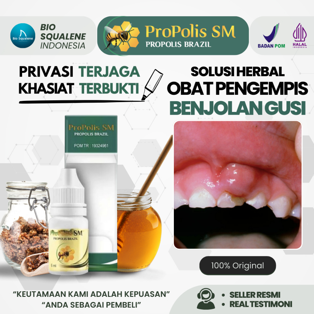 Obat Tumor Gusi Pengempis Benjolan di Mulut Rahang Bengkak Bernanah Berdarah | Penghilang Nyeri Sari