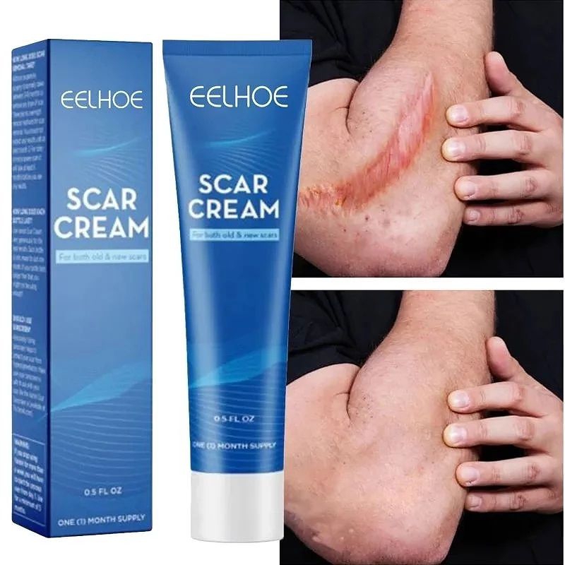 Gel Penghilang Bekas Luka Scar / Keloid / Luka Bakar / Eelhoe Cream Scar Gel