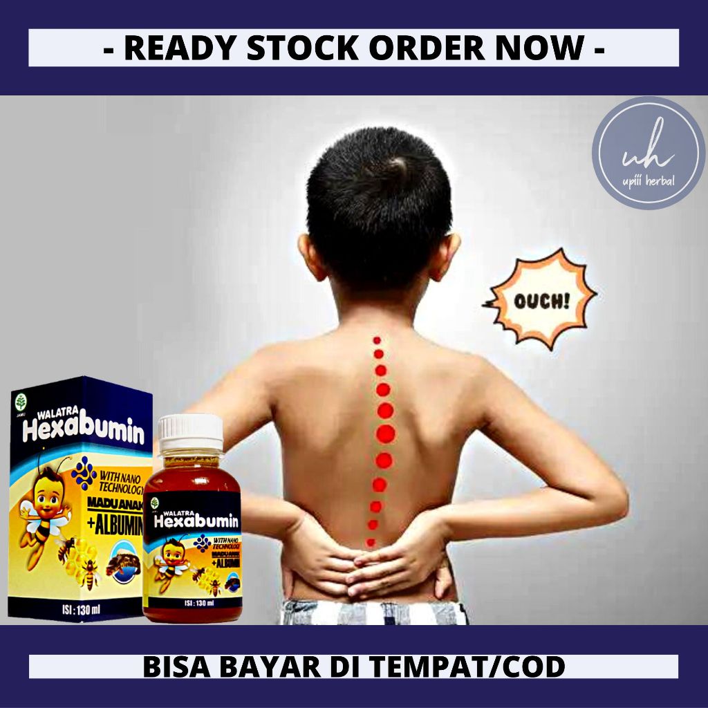 Vitamin Tulang Anak, Obat Penguat Tulang Anak, Vitamin Untuk Sendi Anak, Obat Penguat Tulang Bayi Ba