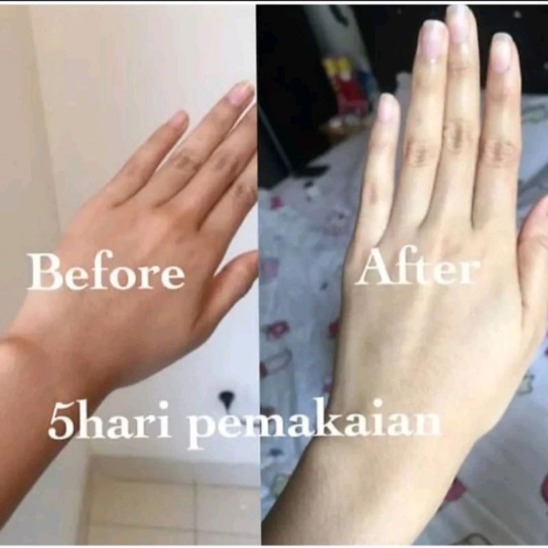 GLUTATHIONE Obat Pemutih Kulit