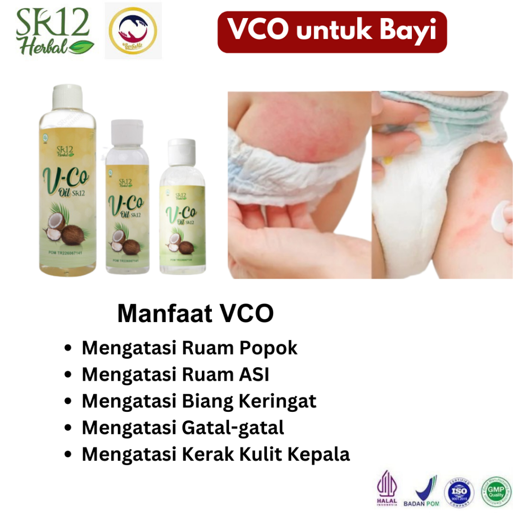 VCO SR12 Untuk Ruam Popok Biang Keringat Minyak Kelapa Murni Untuk Bayi Obat Gatal Eksim Bruntusan