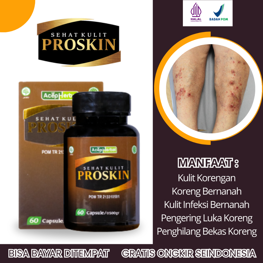 Obat Koreng Bernanah, Obat Kulit Koreng, Obat Gatal Koreng, Obat Koreng di Kaki, Obat Koreng di Tang