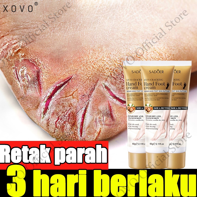 Mall kaki obat kaki pecah dan kering krim obat kaki pecah pecah 6g alat kaki pecah pecah cream kaki 