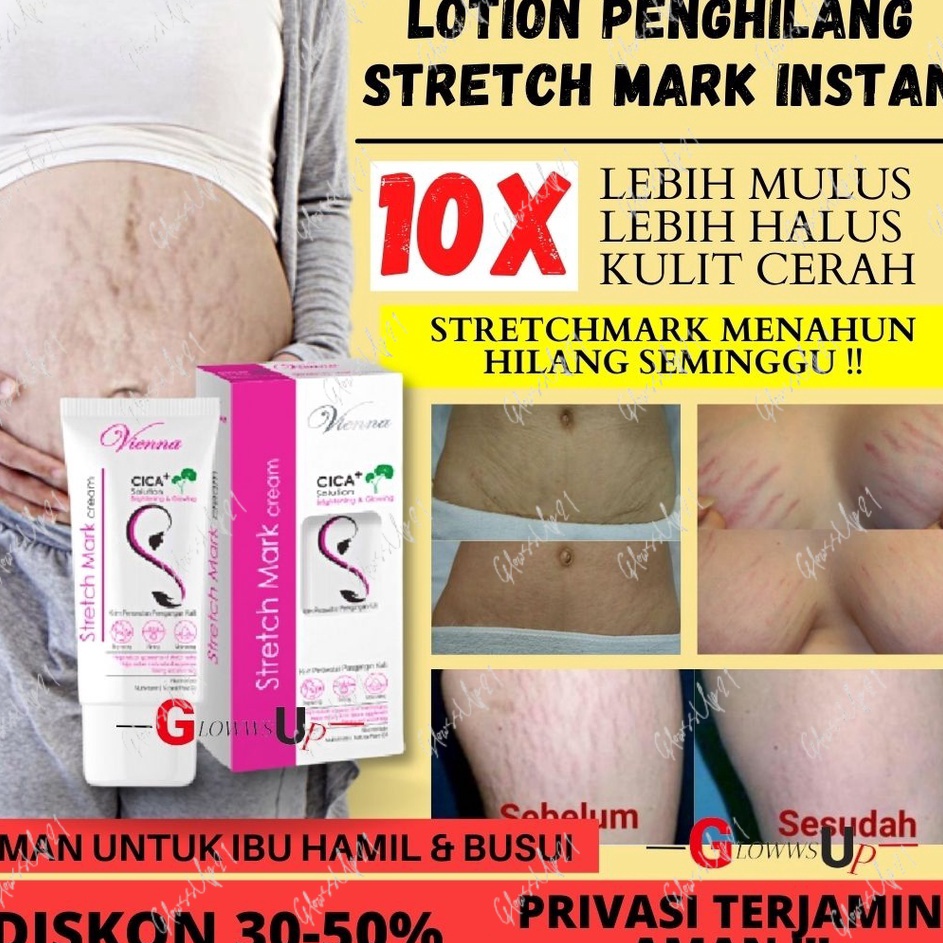 99 BRANDS FESTIVAL CREAM PENGHILANG STRETCH MARK VIENNA STRETCH MARK CREAM ORIGINAL BPOM  ANTI SELUL