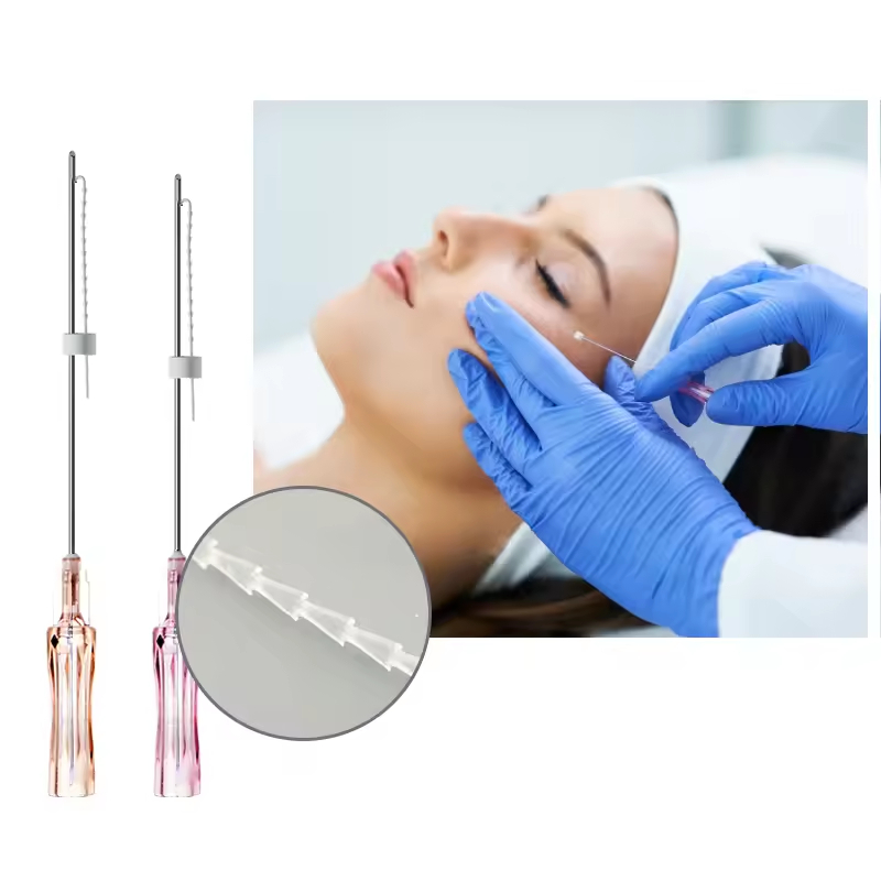 Minerva   Benang Pipi  PDO-PCL  fishbone-molding/1 pack(20benang)