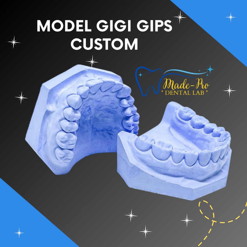 Model Gigi Gips Custom