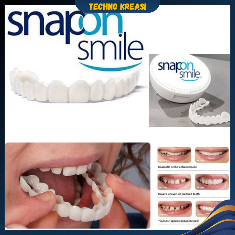 Snap On Smile Gigi Palsu 1 Set Atas Bawah | Gigi Palsu Silikon Veneer Instan Gigi Palsu 1 Set Sepasang Gigi Atas Dan Bawah SK-0031