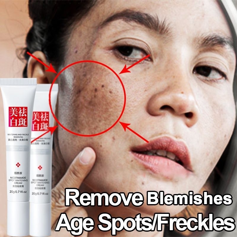 fuyan whitening freckle cream remove dark spot