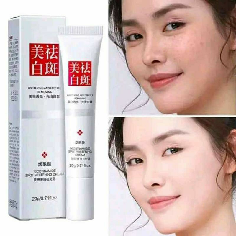 FUYAN nicotinamide spot whitening cream - fu yan whitening and freckle removing cream penghilang fle