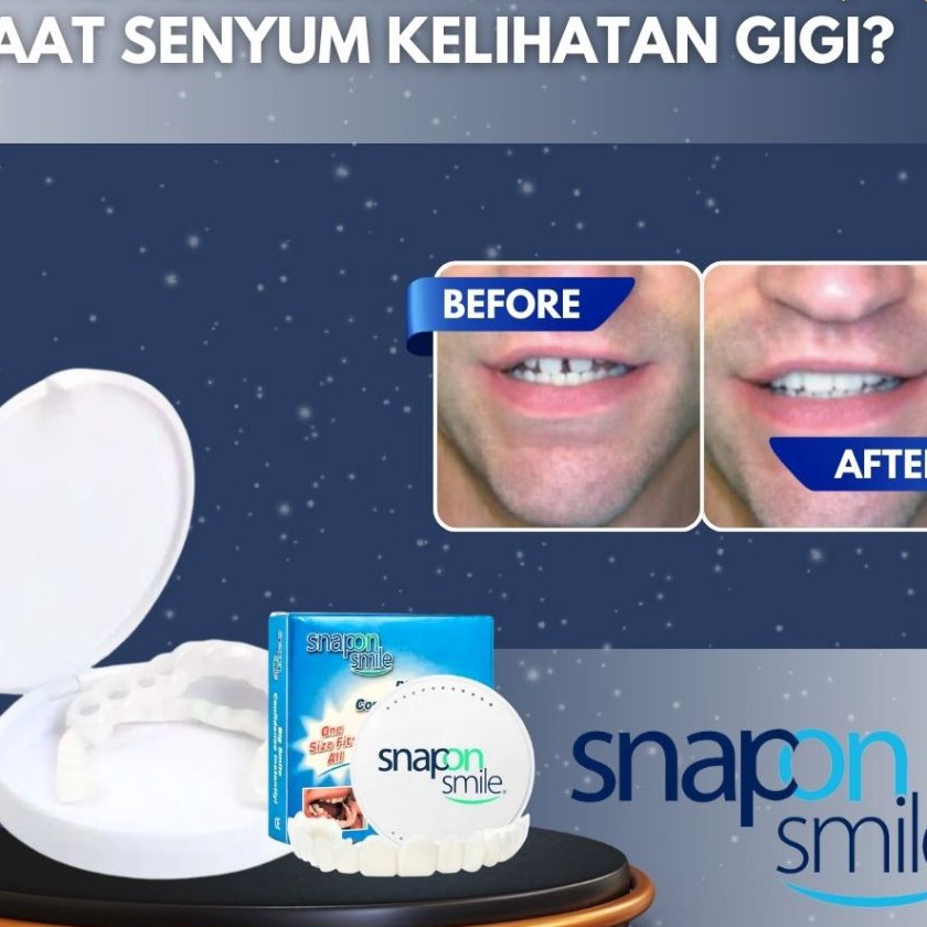 Promo Snap On Smile Veneer Vener Venner Veener Venerr Viner Alat Pemutih Gigi Palsu Instan Silikon t