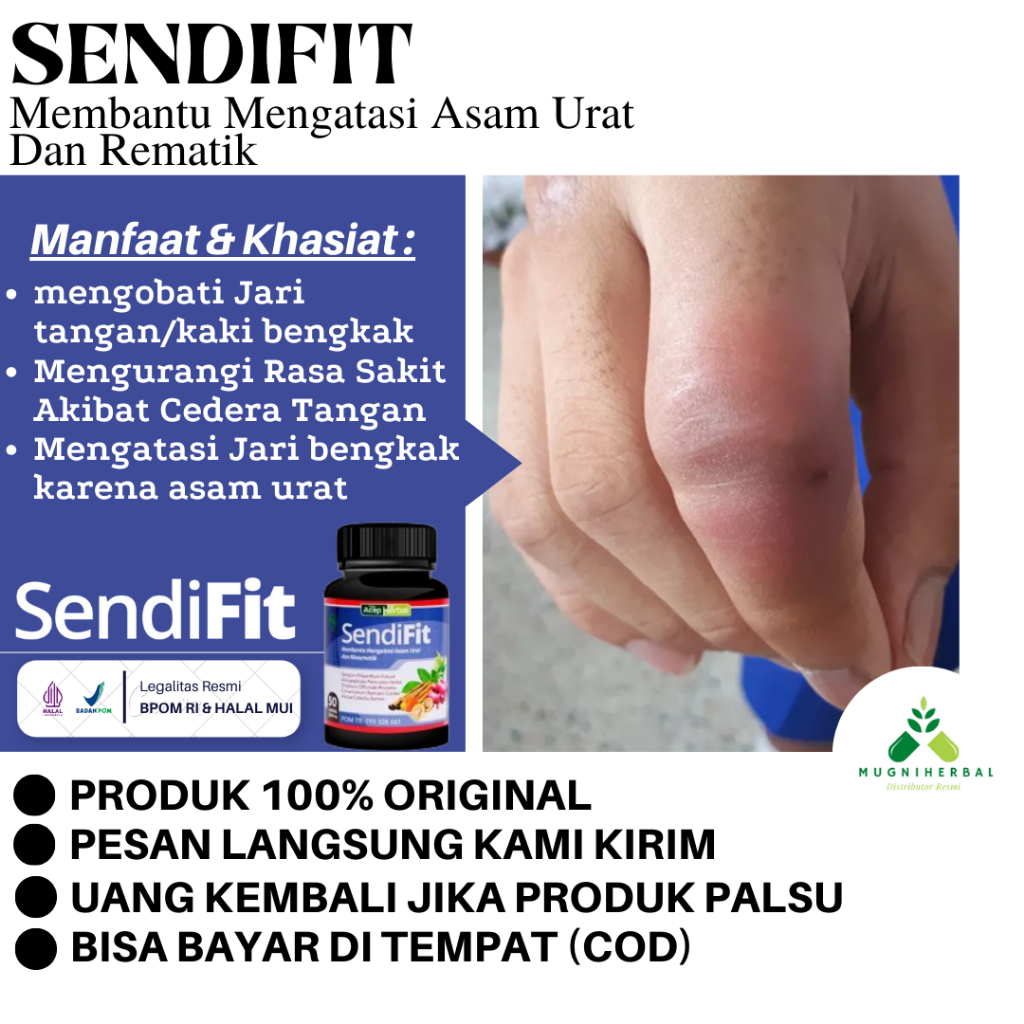 Sendifit Kapsul - Obat Jari Tangan Bengkak, Cedera Jari Tangan, Ibu Jari Bengkak, Jari Bengkak Akiba