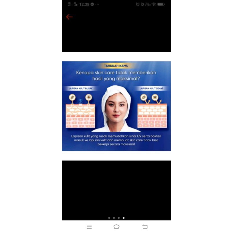 ROYAL MOIST CREAM ESTREMO by Pera-pera menghilangkan flex wajah