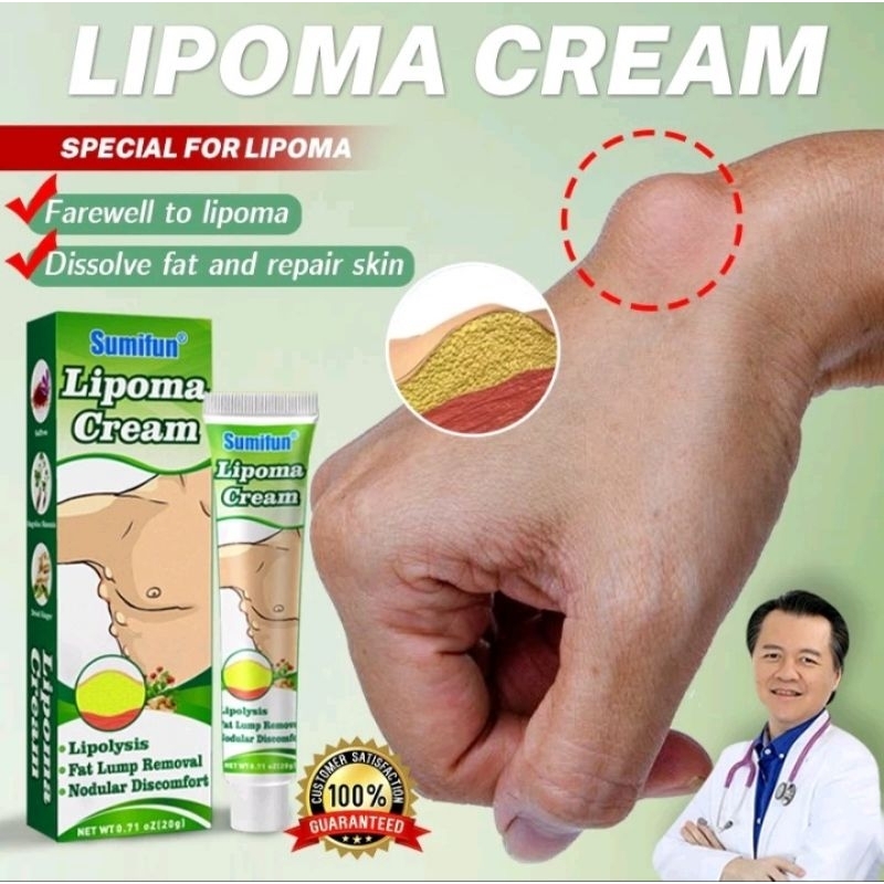 SUMIFUN LIPOMA CREAM OBAT BENJOLAN LIPOMA